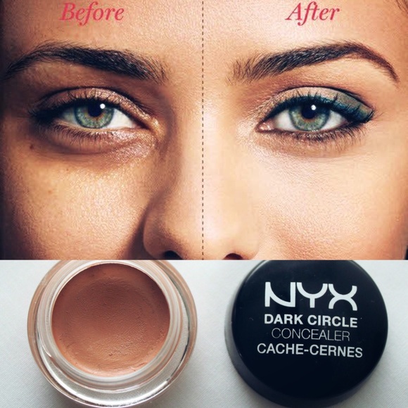 nyx dark circle concealer medium